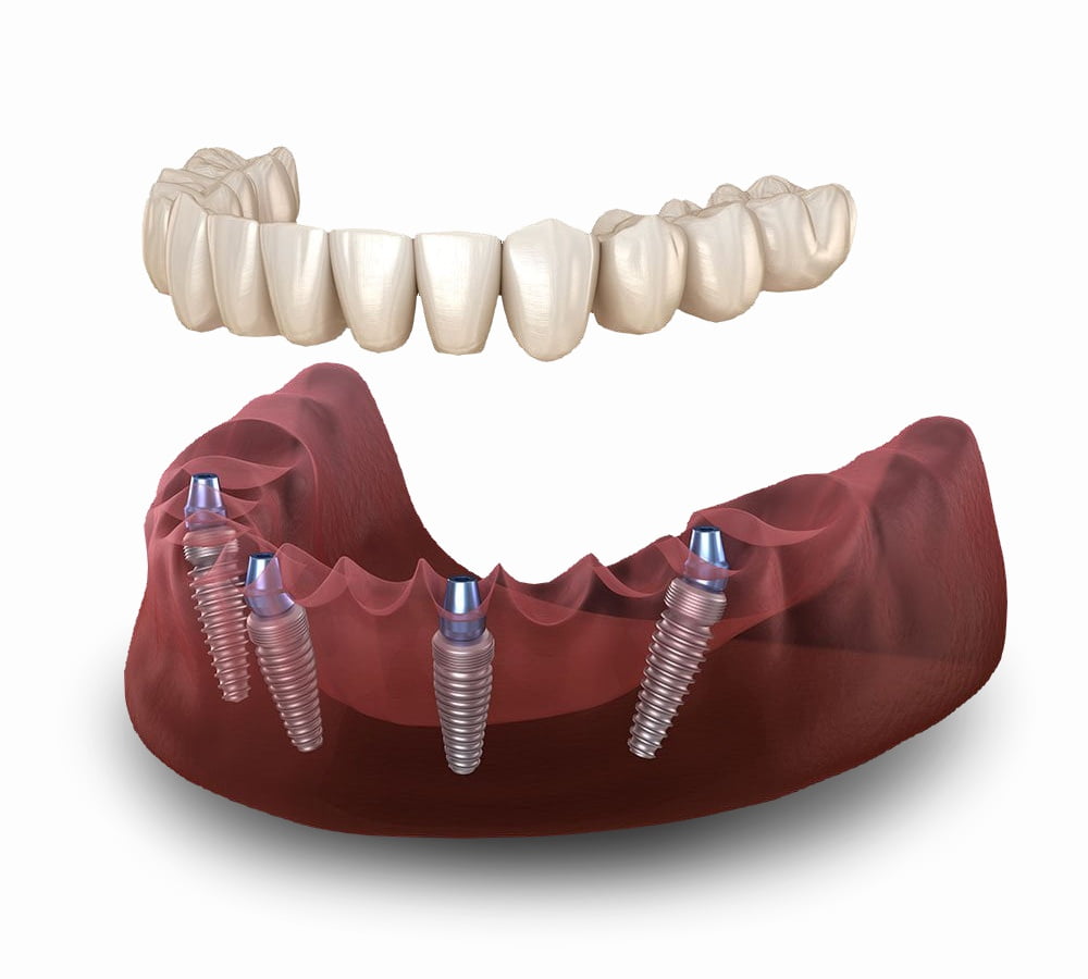 Oral Surgeon in Forest Hills and Jamaica, NY Oral Surgeon in Forest Hills and Jamaica, NY